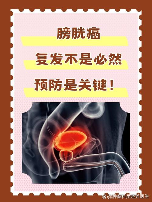 肿瘤不会无故复发，医生直言：肿瘤复发的人，大多是这4事没做好